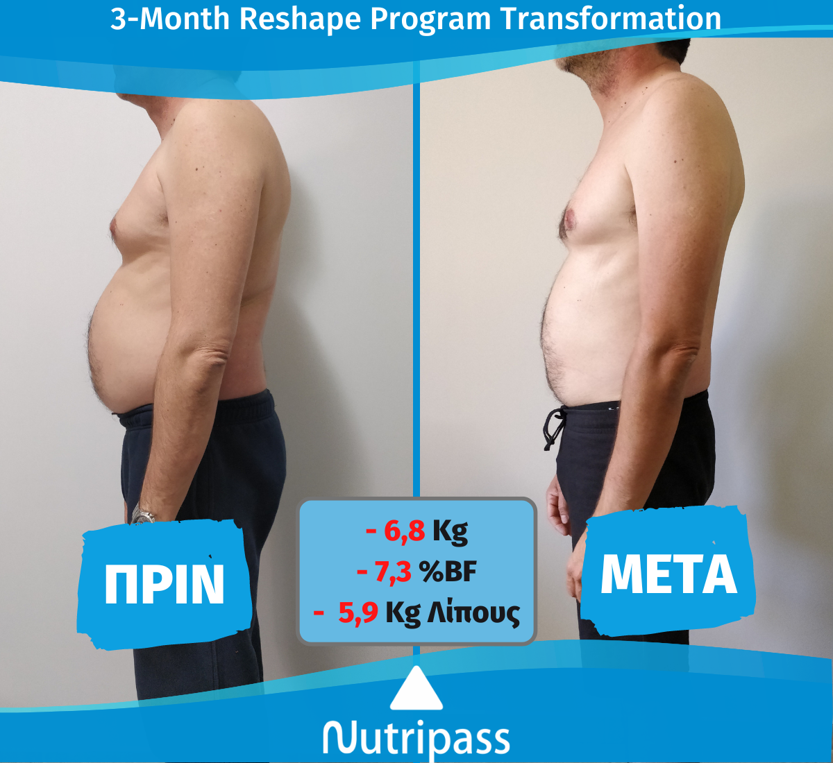 Giorgos Before After Left Side 3 Months New