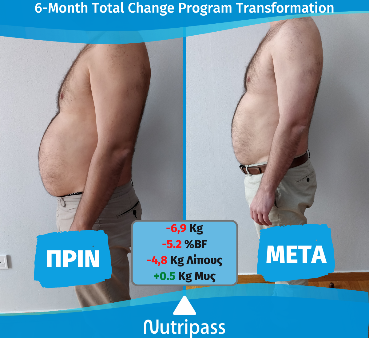 Karvounis Before After Left Side New