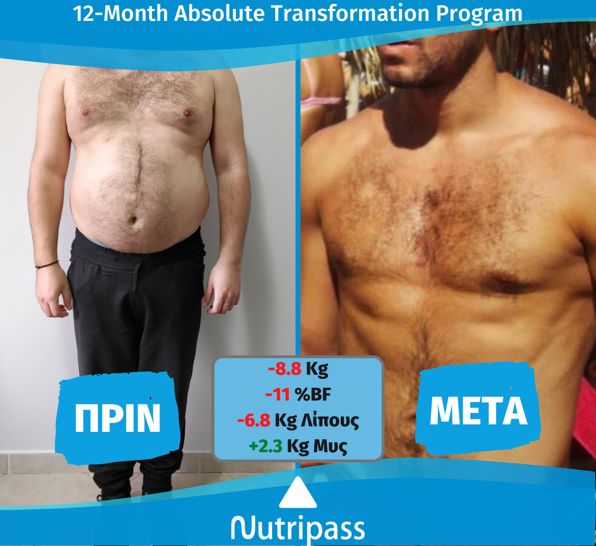 Katsoudas Before After Front Side 12Months New