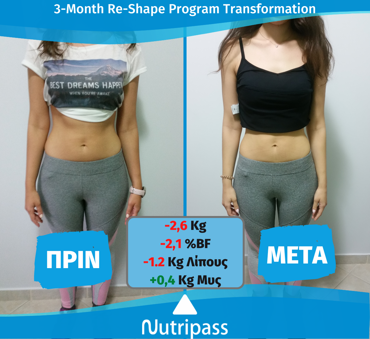 Kollia Before After Front Side 3 Months New