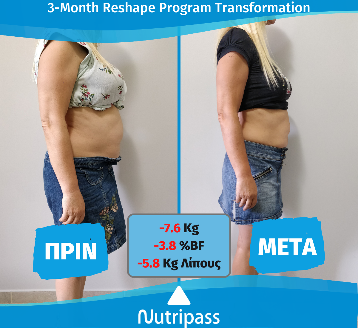 Maragoudaki Before After Right Side 3 Months New