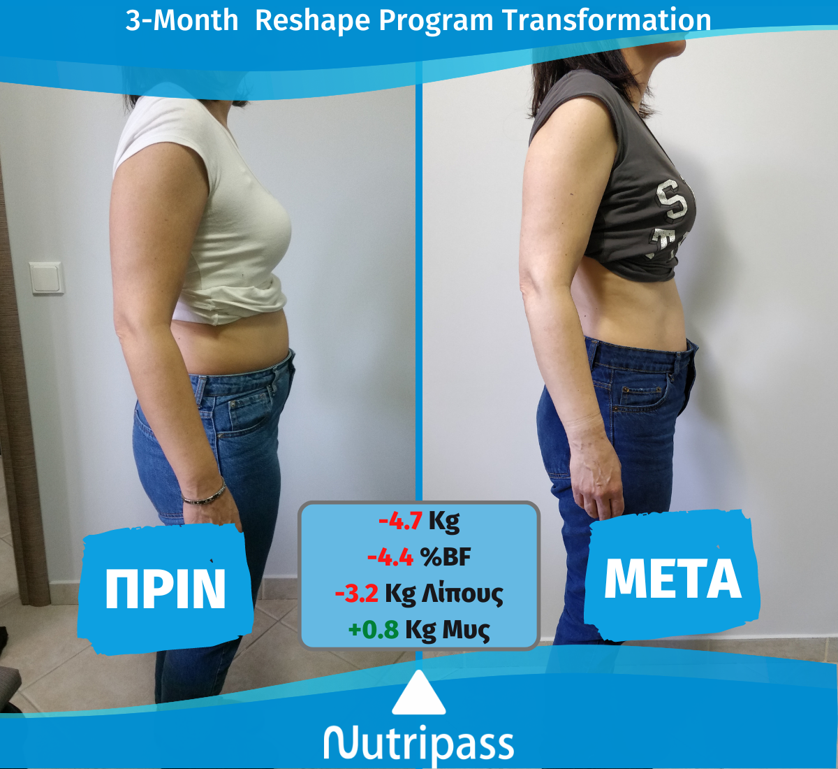 Matthaiou Before After Right Side 3 Months New