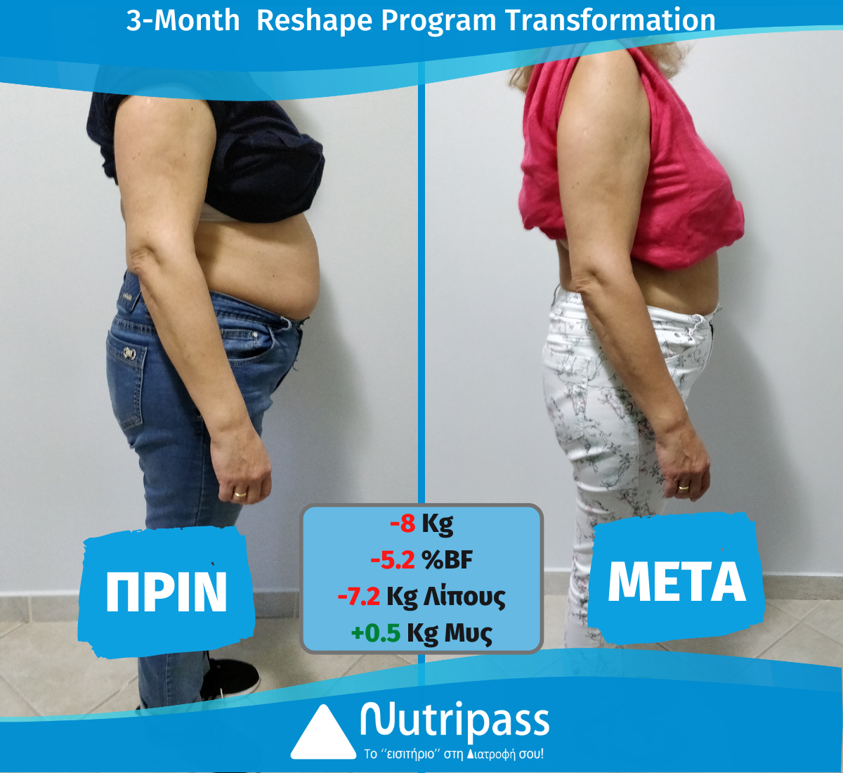 Mauromixalh Before After Righr Side 3 Months New