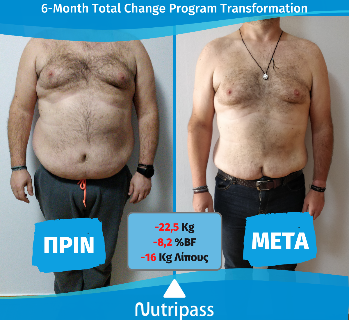 Maxeimaris Before After Front Side 6 Months New