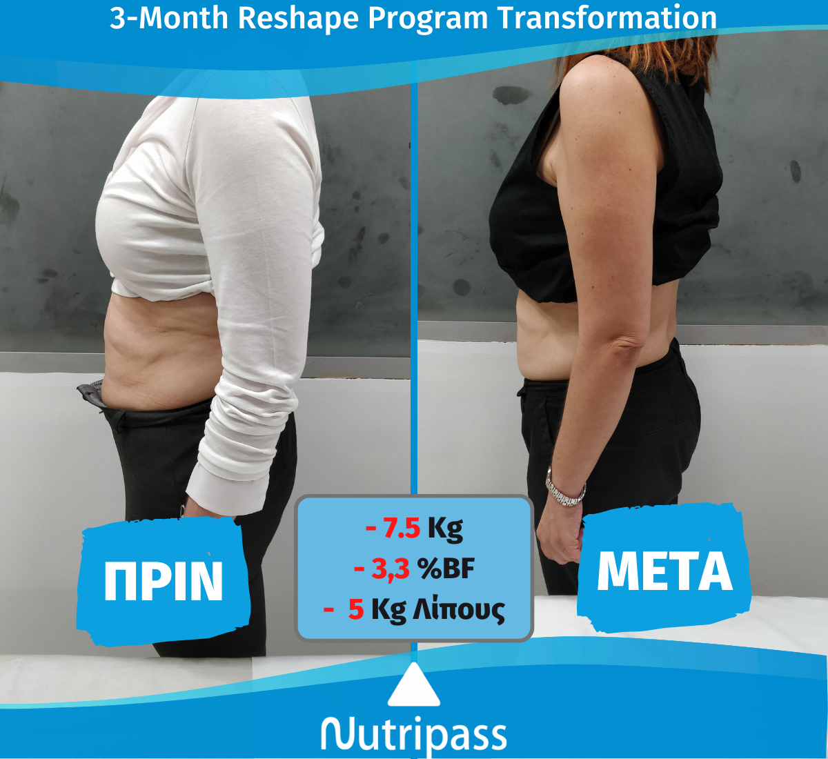 Renieri Before After Left Side 3 Months New