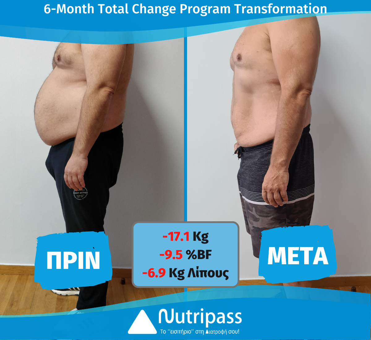 Stamatiou Before After Front Side 6Months new