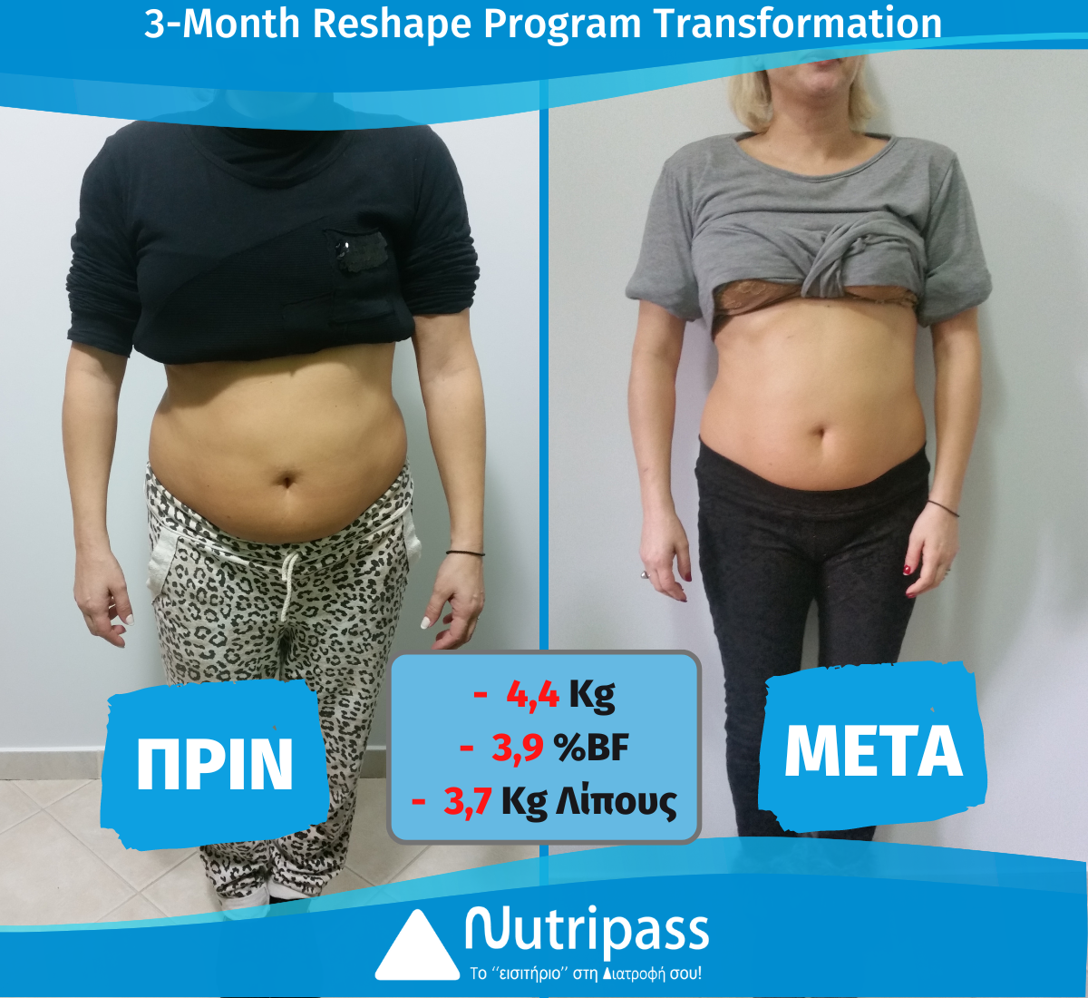 Giannopoulou Before After Front Side 3 Months New