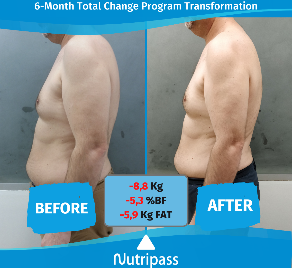 Giankos Before After Left Side 6 Months_English