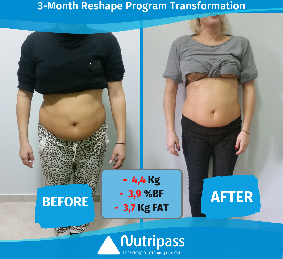 Giannopoulou Before After Front Side 3 Months_English