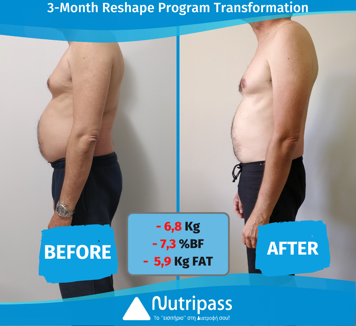 Giorgos Before After Left Side 3 Months_English