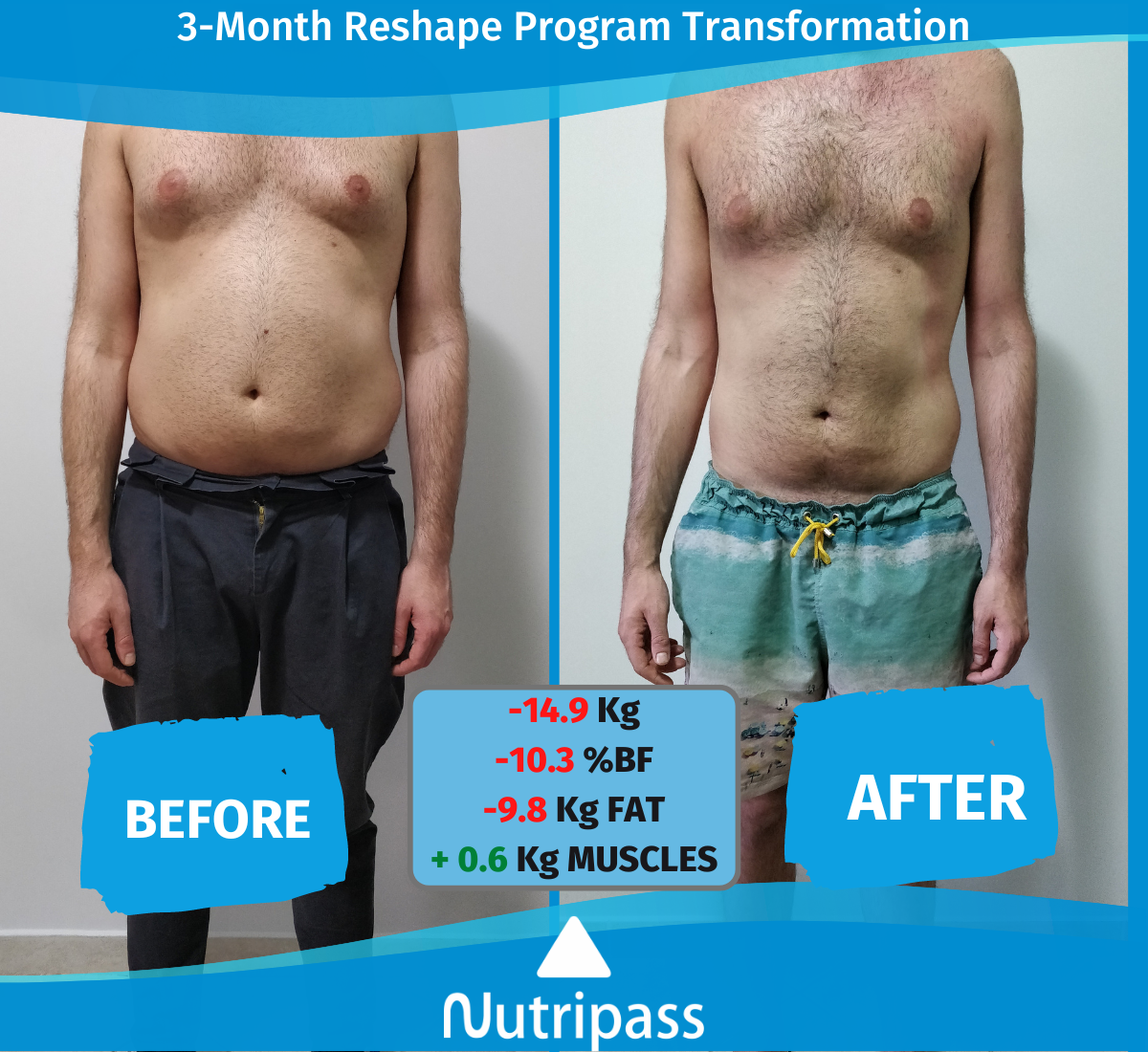 Hatzikos Before After Front Side 3 Months_English