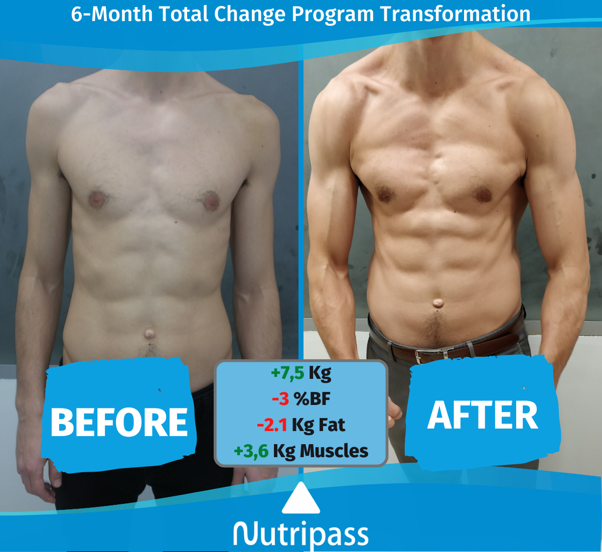 Karapatakis Before After Front Side 6 Months_English