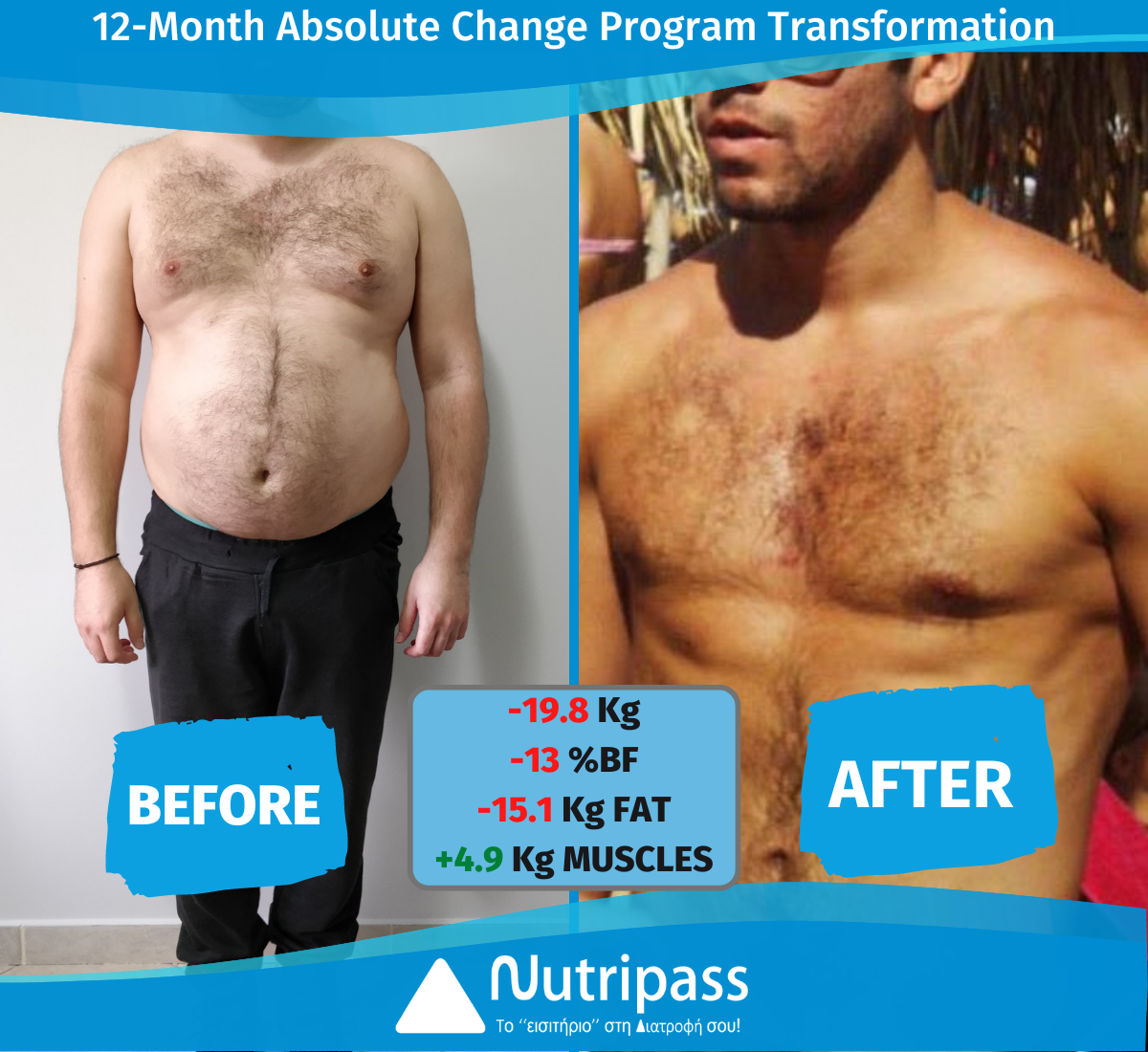 Katsoudas Before After Front Side 12 Months_English