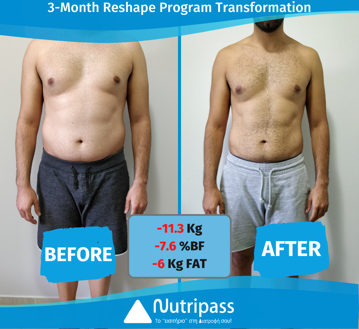 Labropoulos Before After Front Side 3 Months_English (1)