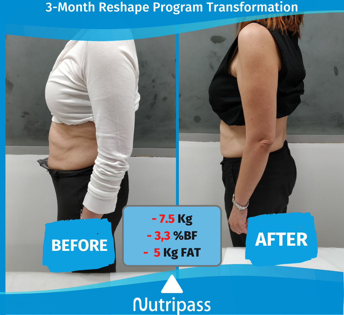 Litsa Before After Left Side 3 Months_ English