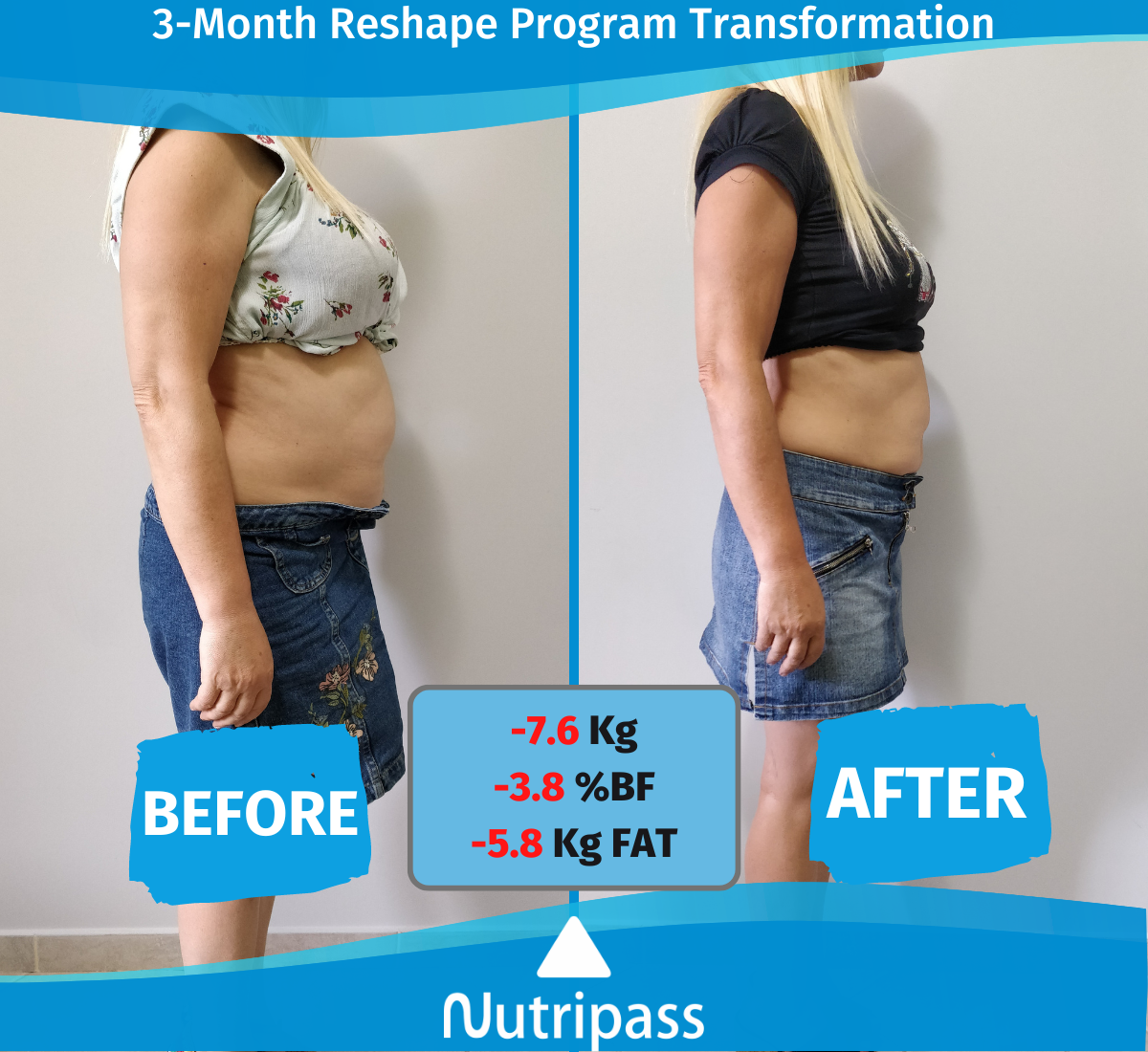 Maragoudaki Before After Right Side 3 Months_English