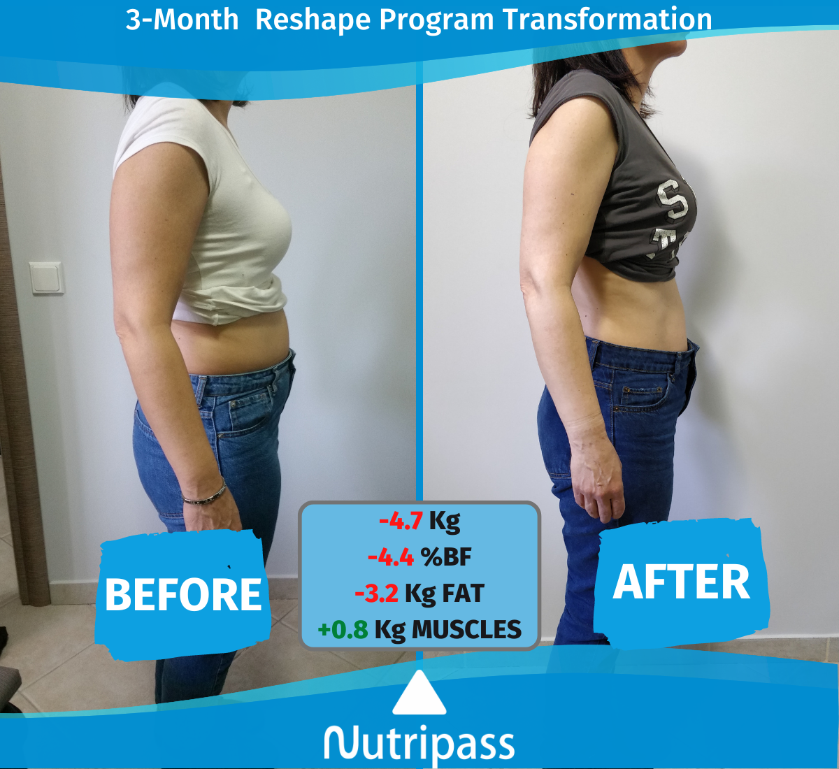 Matthaiou Before After Right Side 3 Months_ English