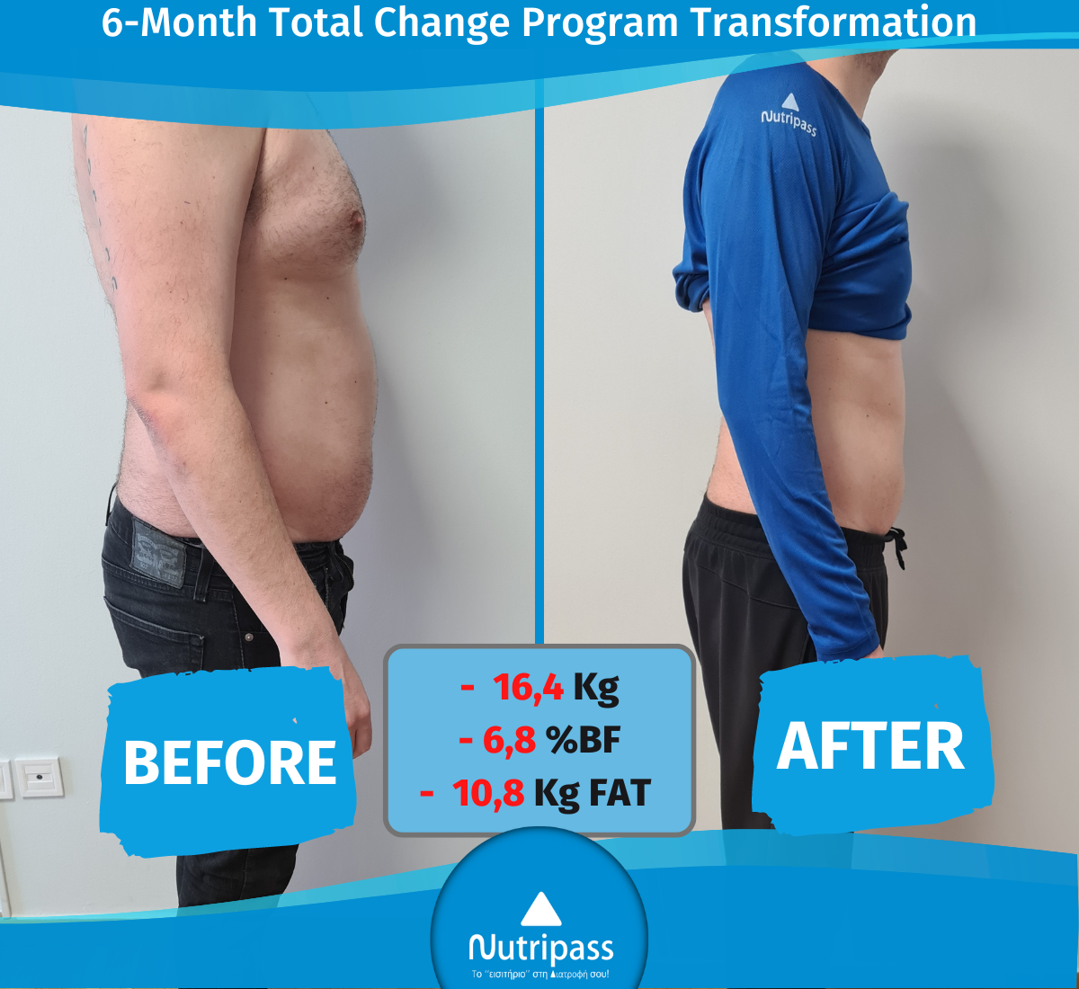 Vakalopoulos Before After Right Side 6 Months_ English